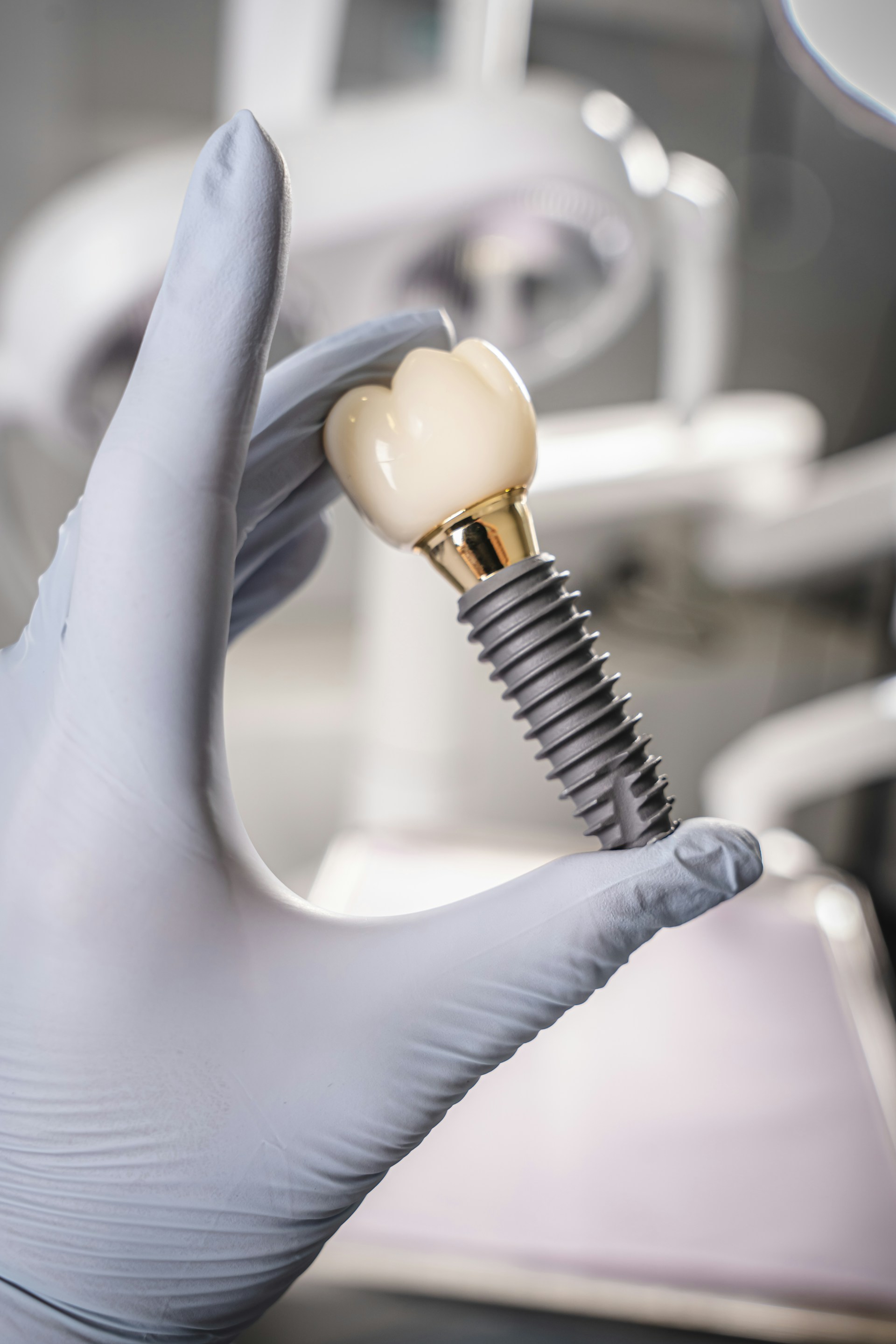 Dental İmplant